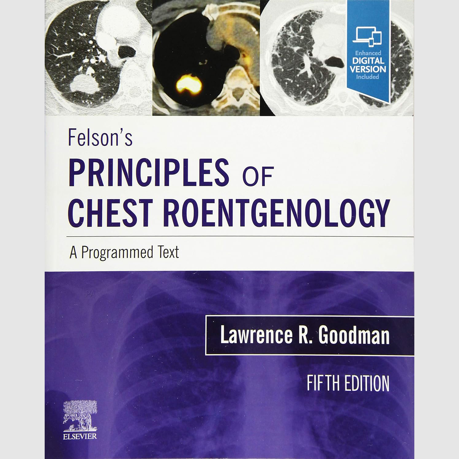 Felson's Principles of Chest Roentgenology, A Programmed Text