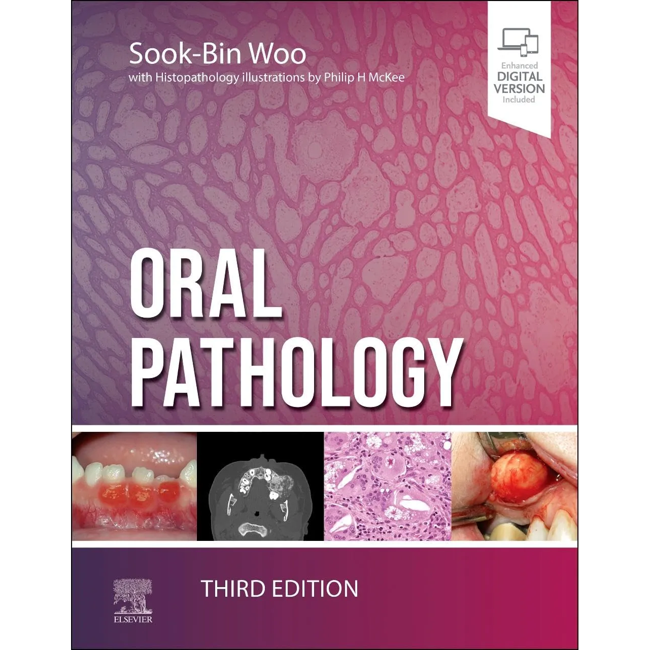 Oral Pathology