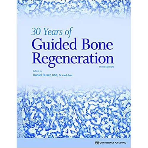 30 Years of Guided Bone Regeneration