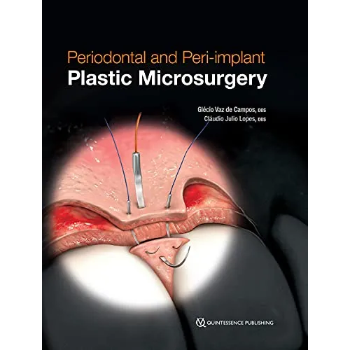 Periodontal and Peri-implant Plastic Microsurgery