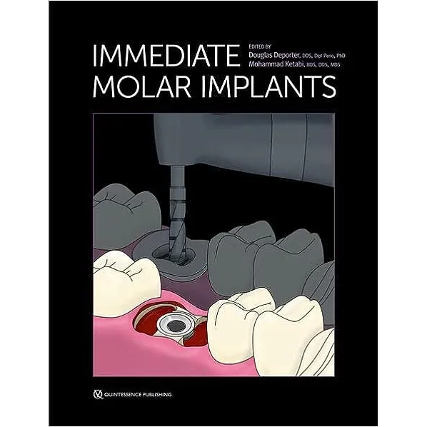 Immediate Molar Implants