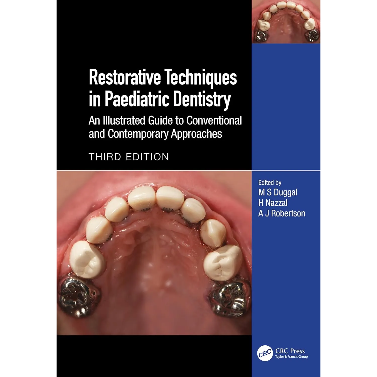 Restorative Techniques in Paediatric Dentistry: An Illustrated Guide to Conventional and Contemporar