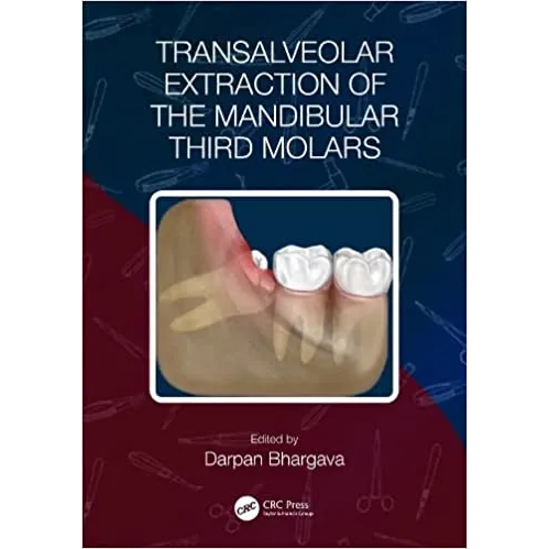 Transalveolar Extraction of the Mandibular Third Molars