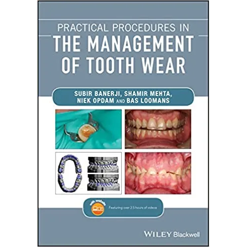 Practical Procedures in the Management of Tooth Wear