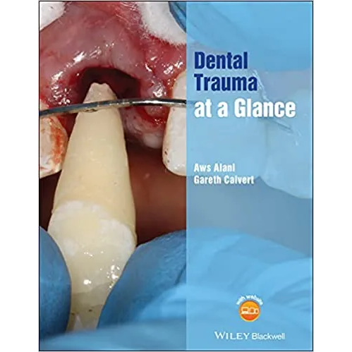 Dental Trauma at a Glance