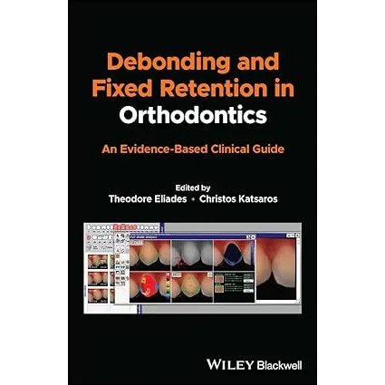 Debonding and Fixed Retention in Orthodontics: An Evidence-Based Clinical Guide