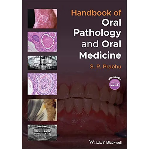 Handbook of Oral Pathology and Oral Medicine