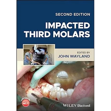 Impacted Third Molars