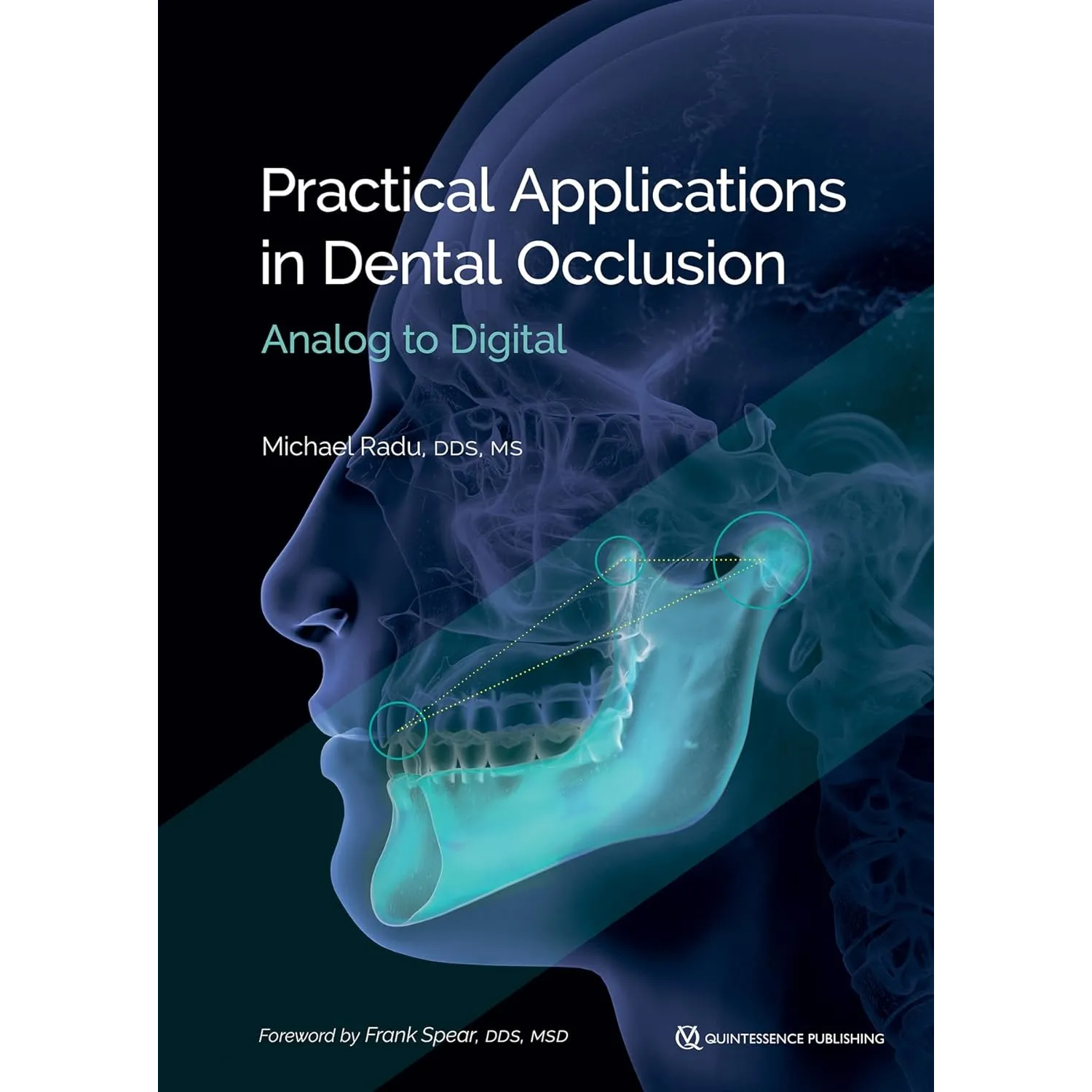 Practical Applications in Dental Occlusion: Analog to Digital