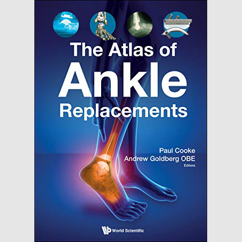 The Atlas Of Ankle Replacement