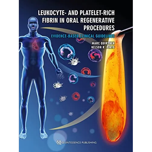 Leukocyte- and Platelet-Rich Fibrin in Oral Regenerative Procedures: Evidence-Based Clinical Guidelines