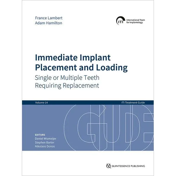 ITI Treatment Guide Vol.14:Immediate Implant Placement and Loading: Single or Multiple Teeth Requiring Replacement