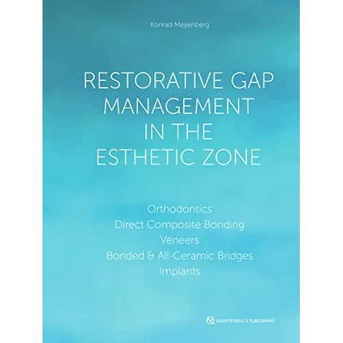 Restorative Gap Management in the Esthetic Zone: Orthodontics,Direct Composite Bonding,Veneers,Bonde