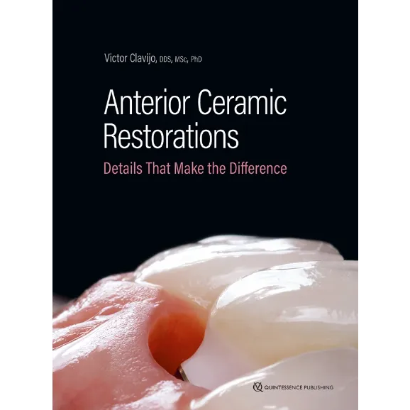 Anterior Ceramic Restorations: Details That Make the Difference