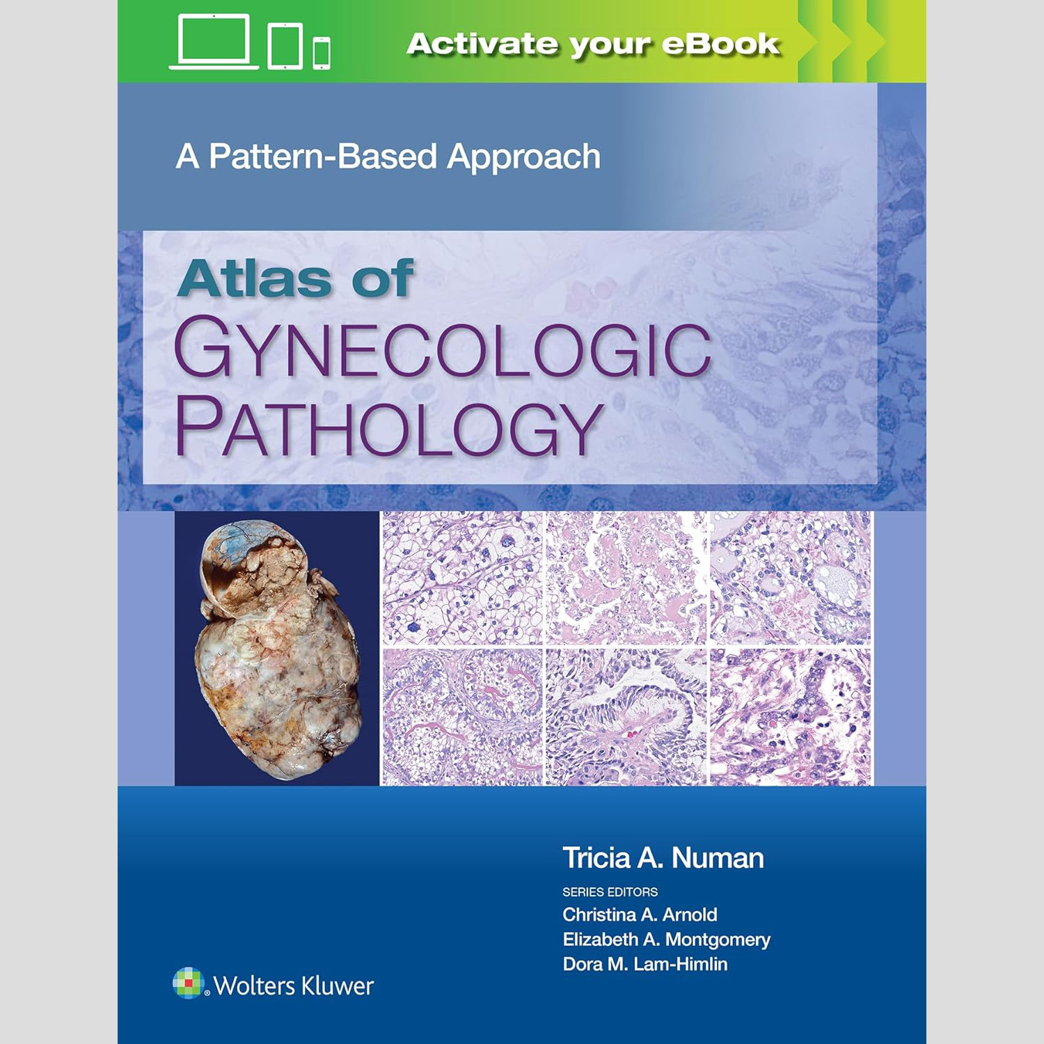 (電子書) Atlas of Gynecologic Pathology