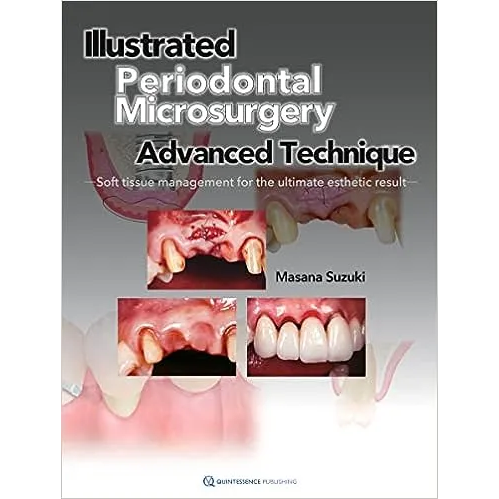 Illustrated Periodontal Microsurgery: Advanced Technique Soft Tissue Management for the Ultimate Esthetic Result