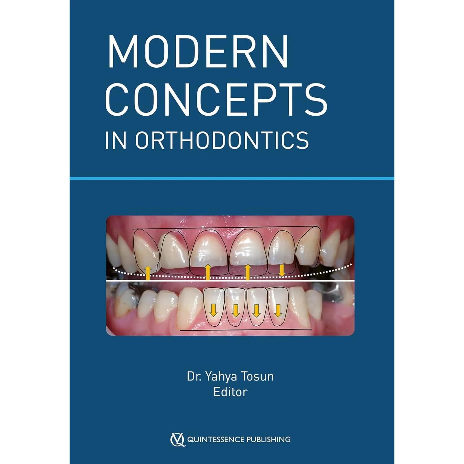 Modern Concepts in Orthodontics