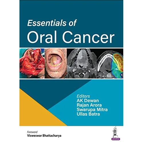 Essentials of Oral Cancer