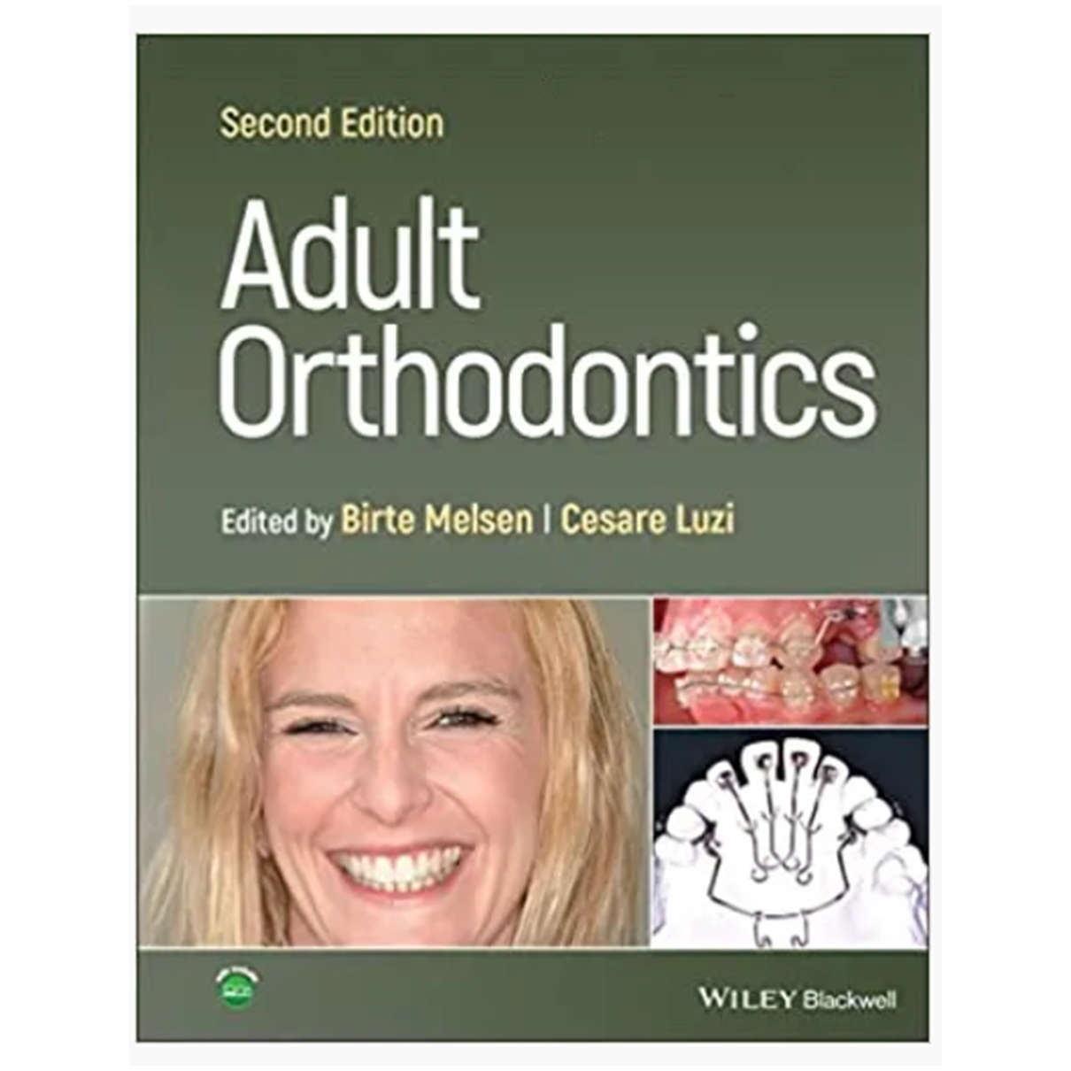 Adult Orthodontics