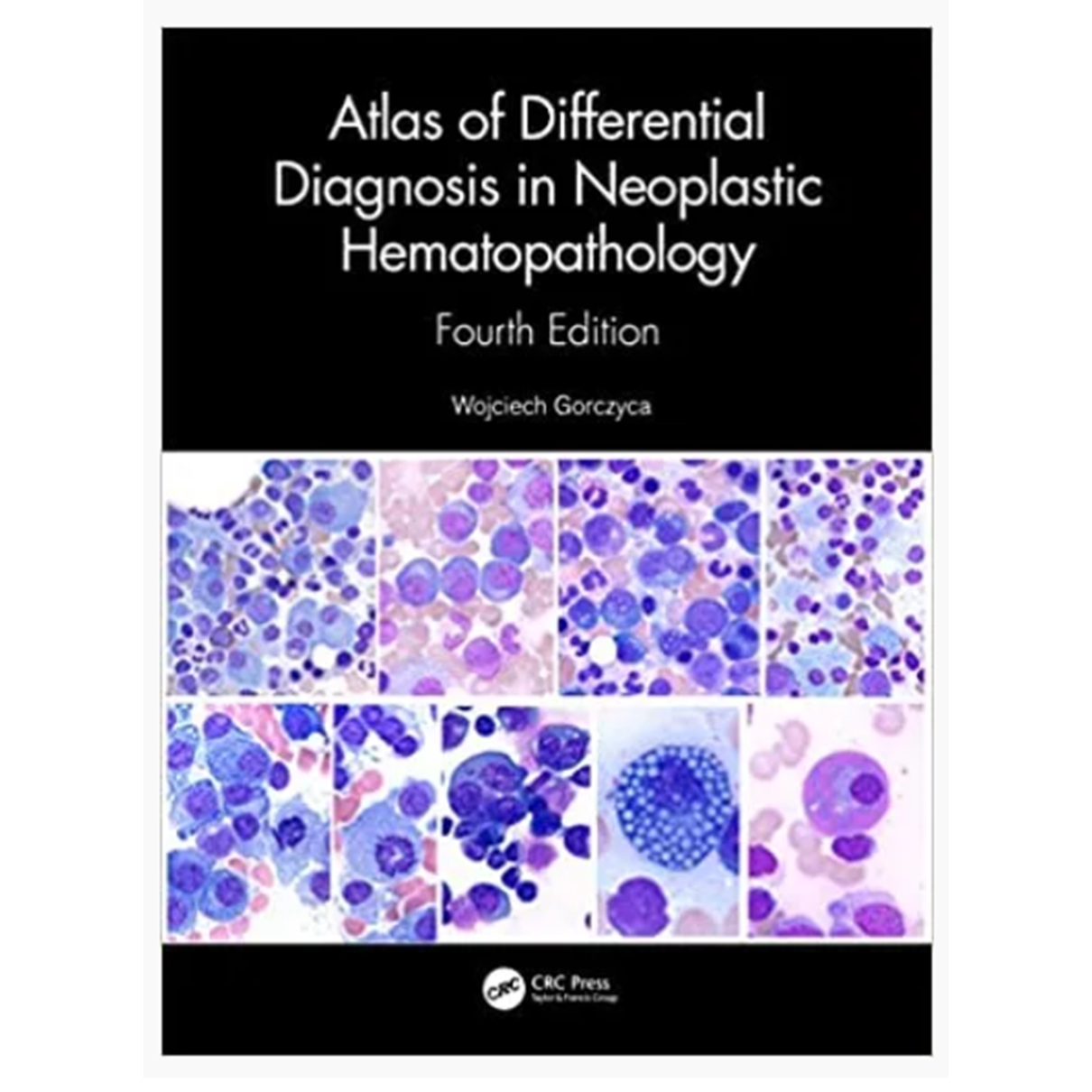 Atlas of Differential Diagnosis in Neoplastic Hematopathology