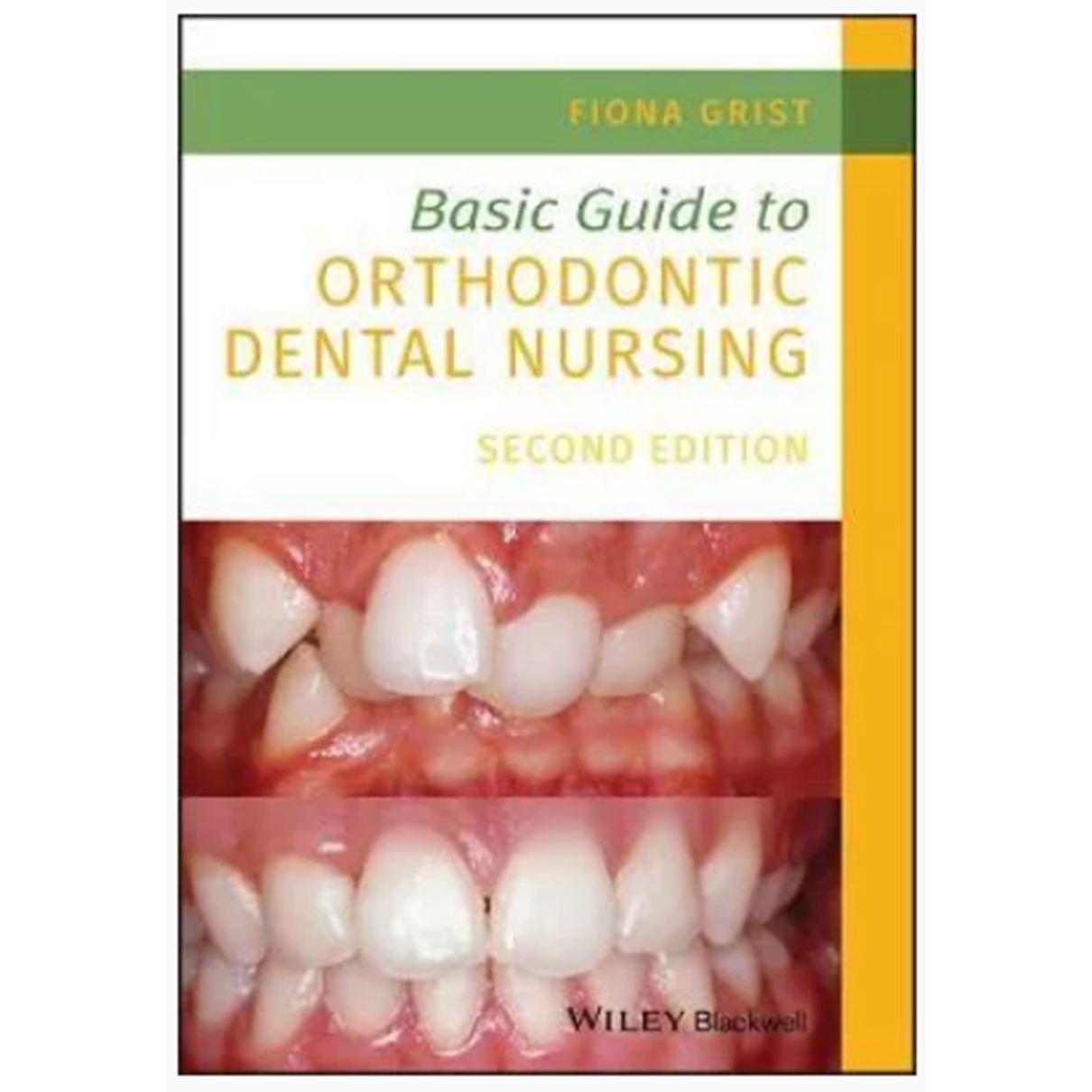 Basic Guide to Orthodontic Dental Nursing