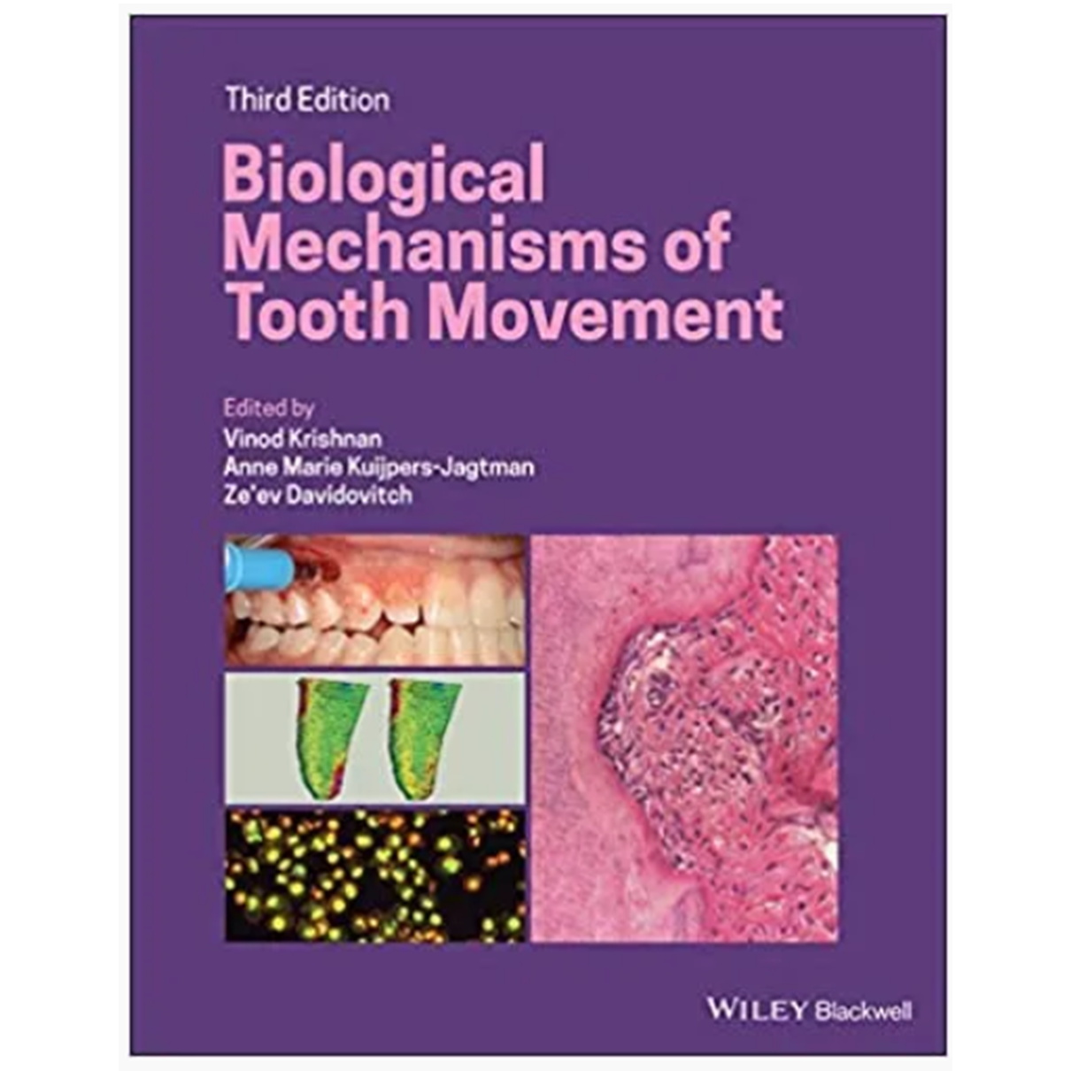 Biological Mechanisms of Tooth Movement