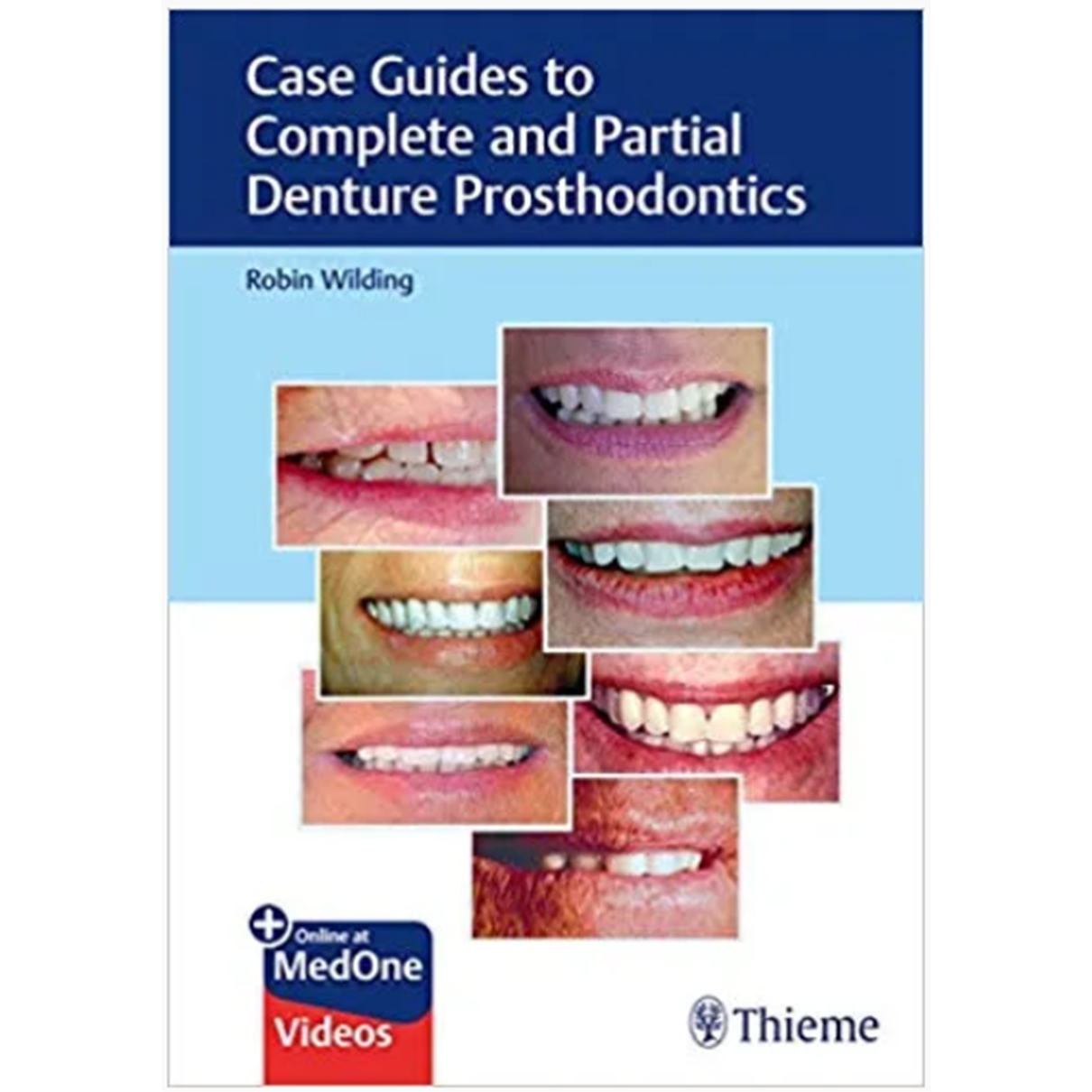 Case Guides to Complete and Partial Denture Prosthodontics