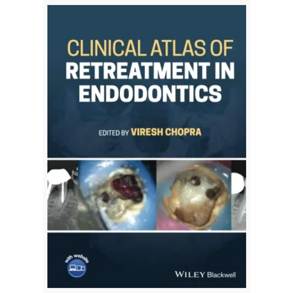 Clinical Atlas of Retreatment in Endodontics