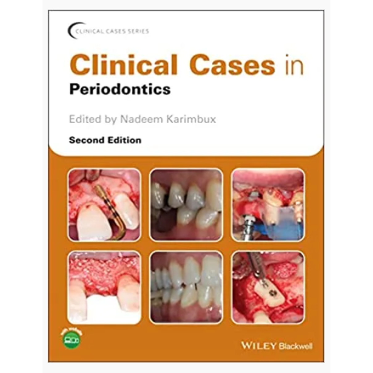 Clinical Cases in Periodontics