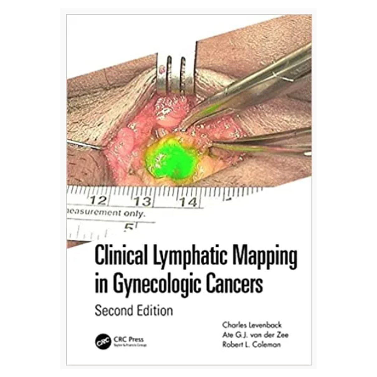 Clinical Lymphatic Mapping in Gynecologic Cancers