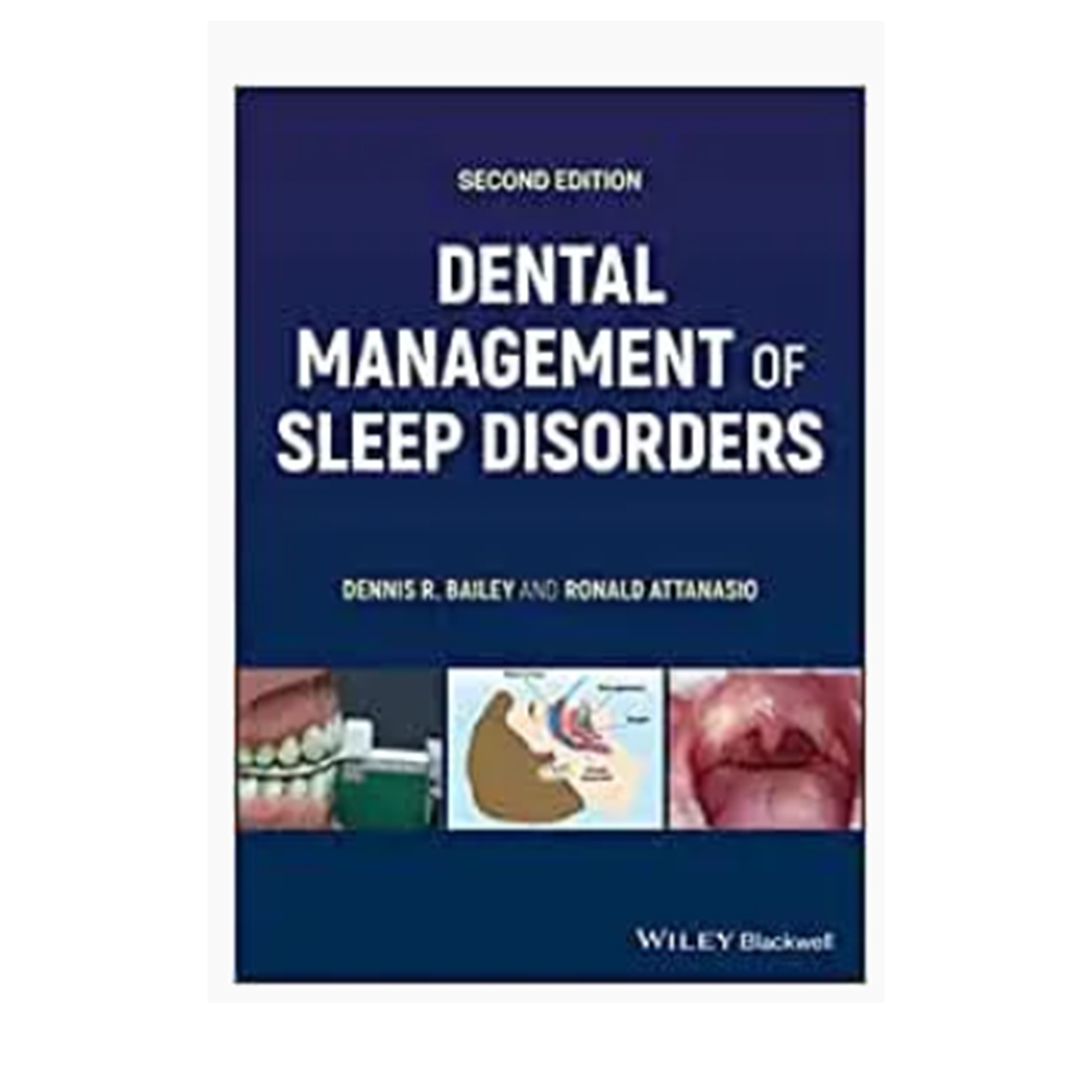 Dental Management of Sleep Disorders