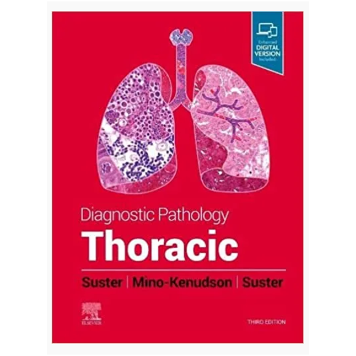 Diagnostic Pathology: Thoracic