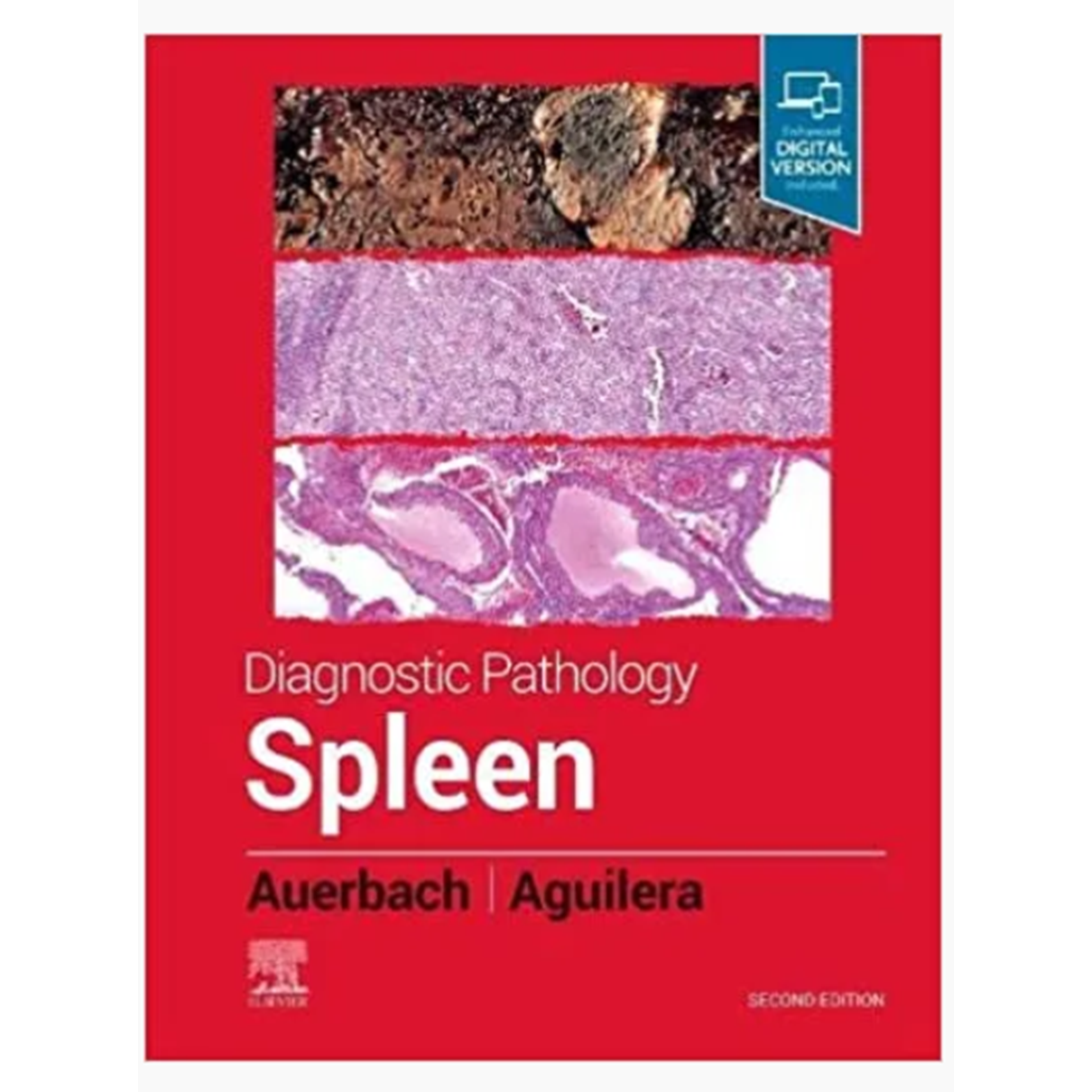 Diagnostic Pathology: Spleen