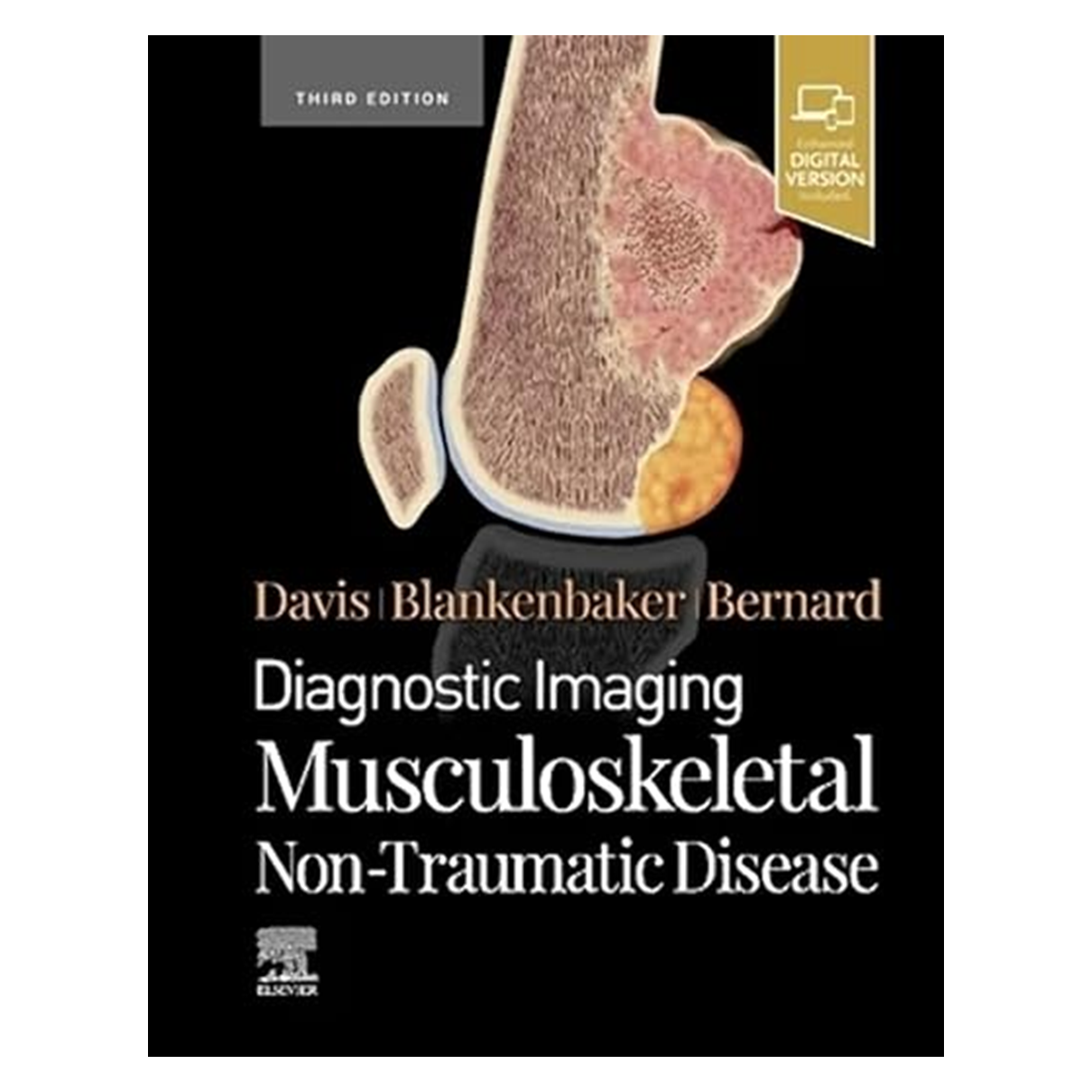 Diagnostic Imaging: Musculoskeletal Non-Traumatic Disease