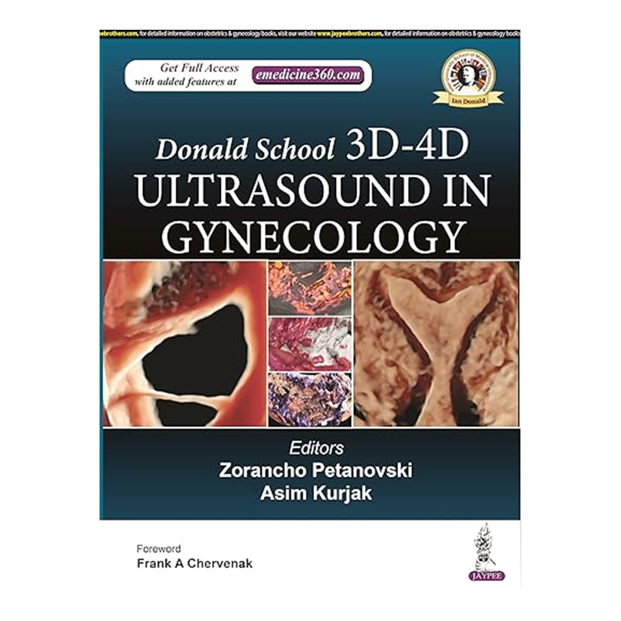 Donald School 3D-4D Ultrasound in Gynecology