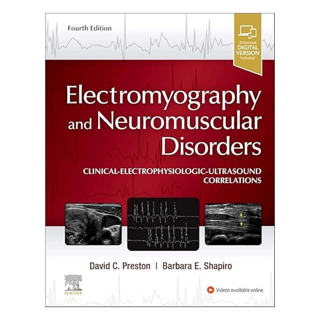 Electromyography and Neuromuscular Disorders: Clinical-Electrophysiologic-Ultrasound Correlations