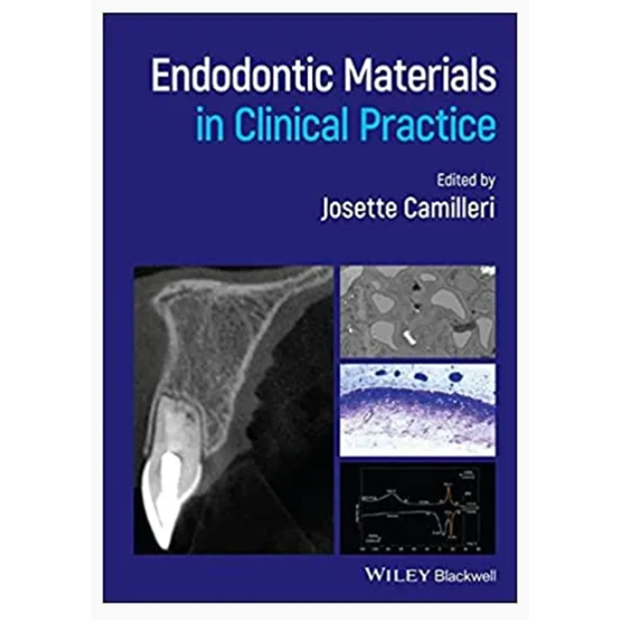 Endodontic Materials in Clinical Practice