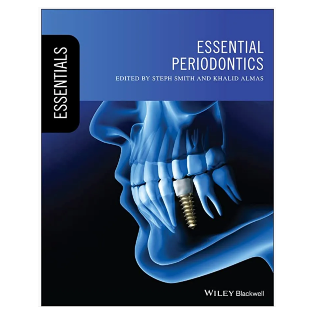 Essential Periodontics