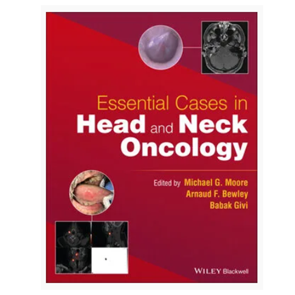 Essential Cases in Head and Neck Oncology