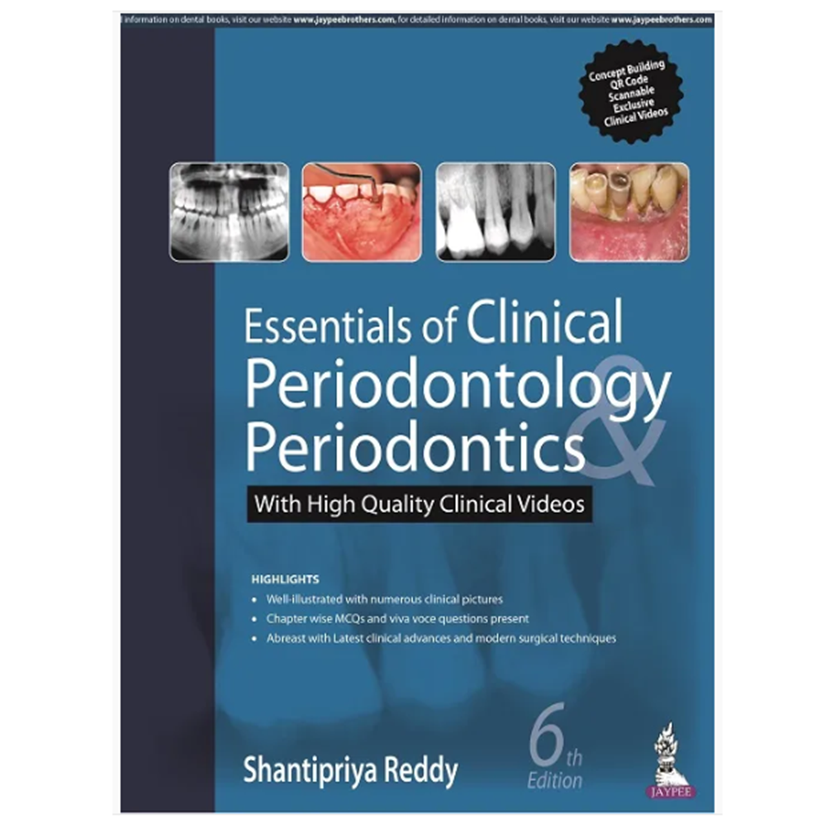 Essentials of Clinical Periodontology & Periodontics