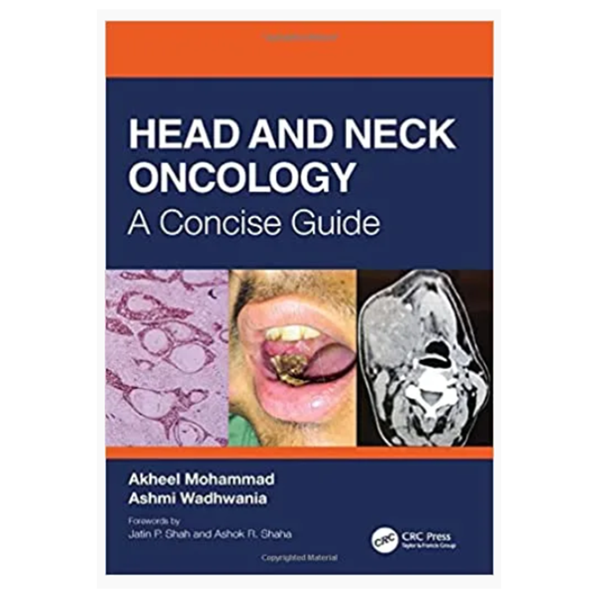 Head and Neck Oncology: A Concise Guide