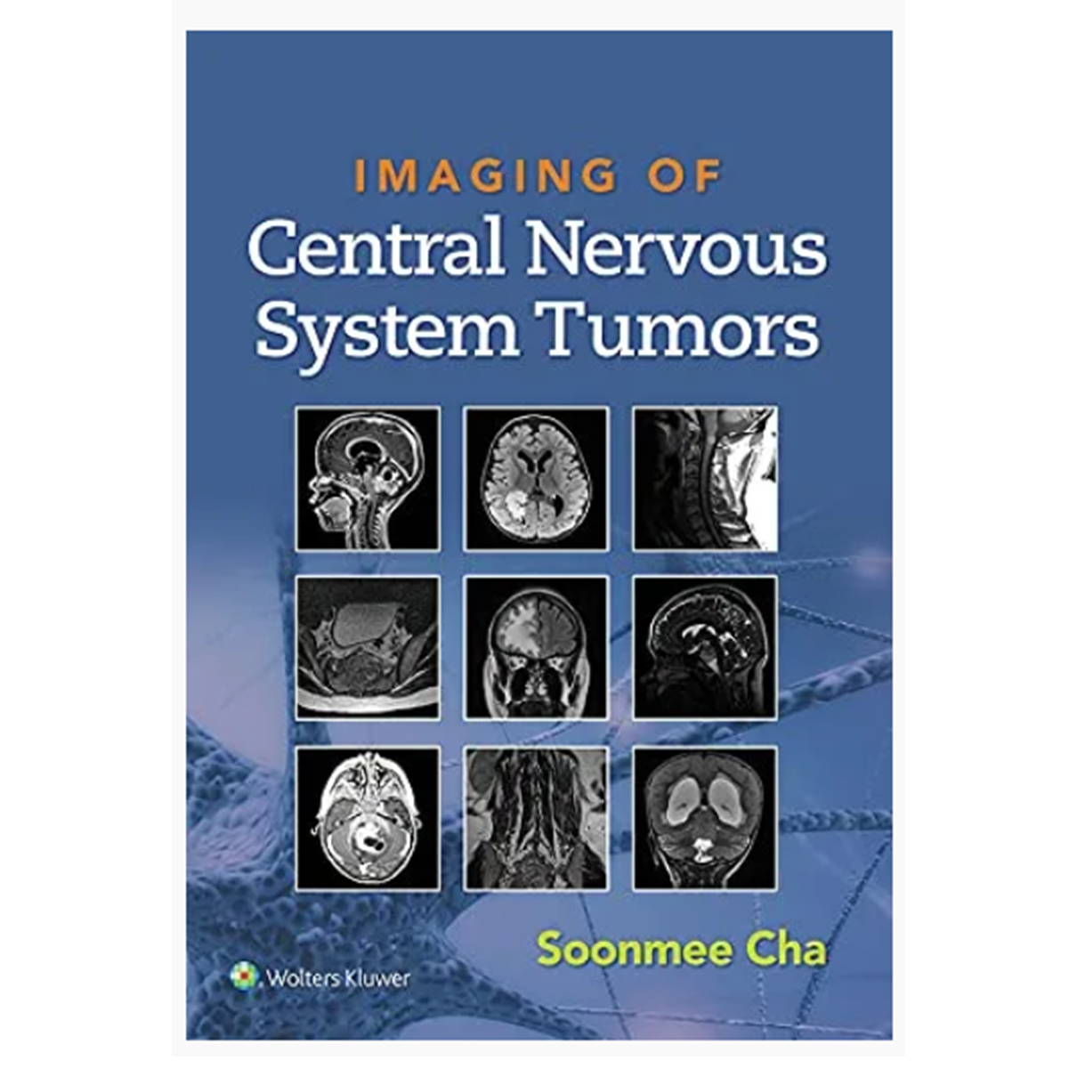 Imaging of Central Nervous System Tumors