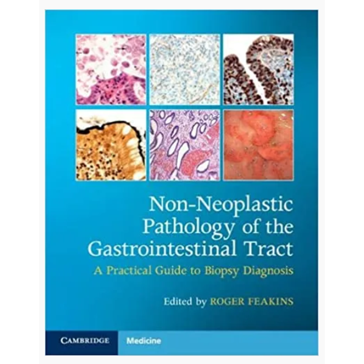 Non-Neoplastic Pathology of the Gastrointestinal Tract: A Practical Guide to Biopsy Diagnosis