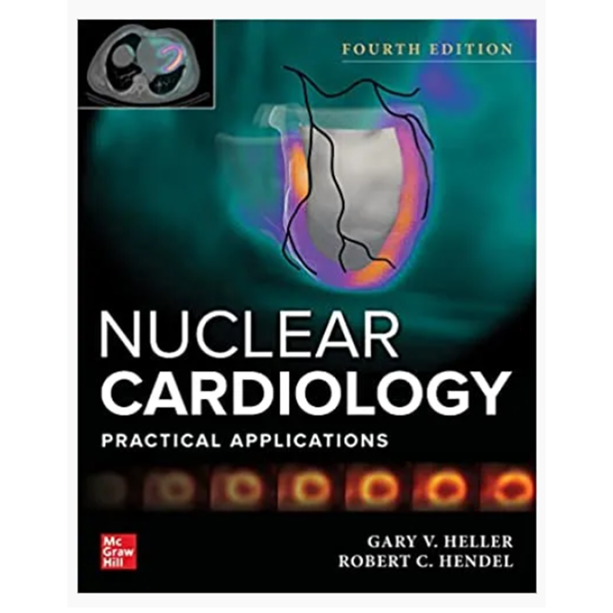 Nuclear Cardiology: Practical Applications