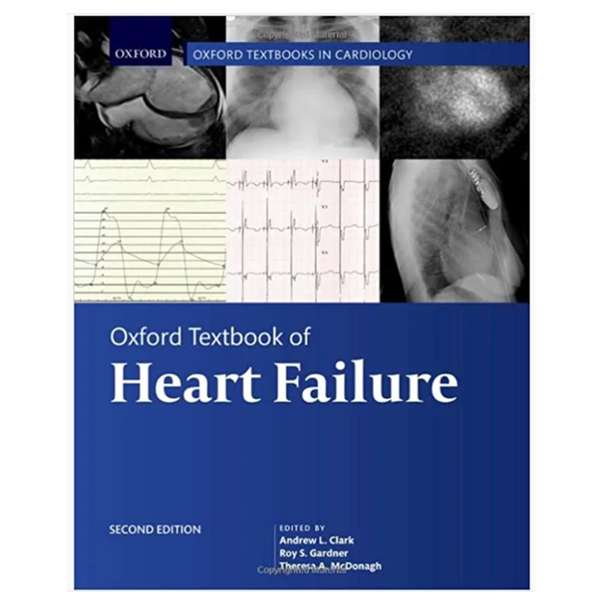 Oxford Textbook of Heart Failure