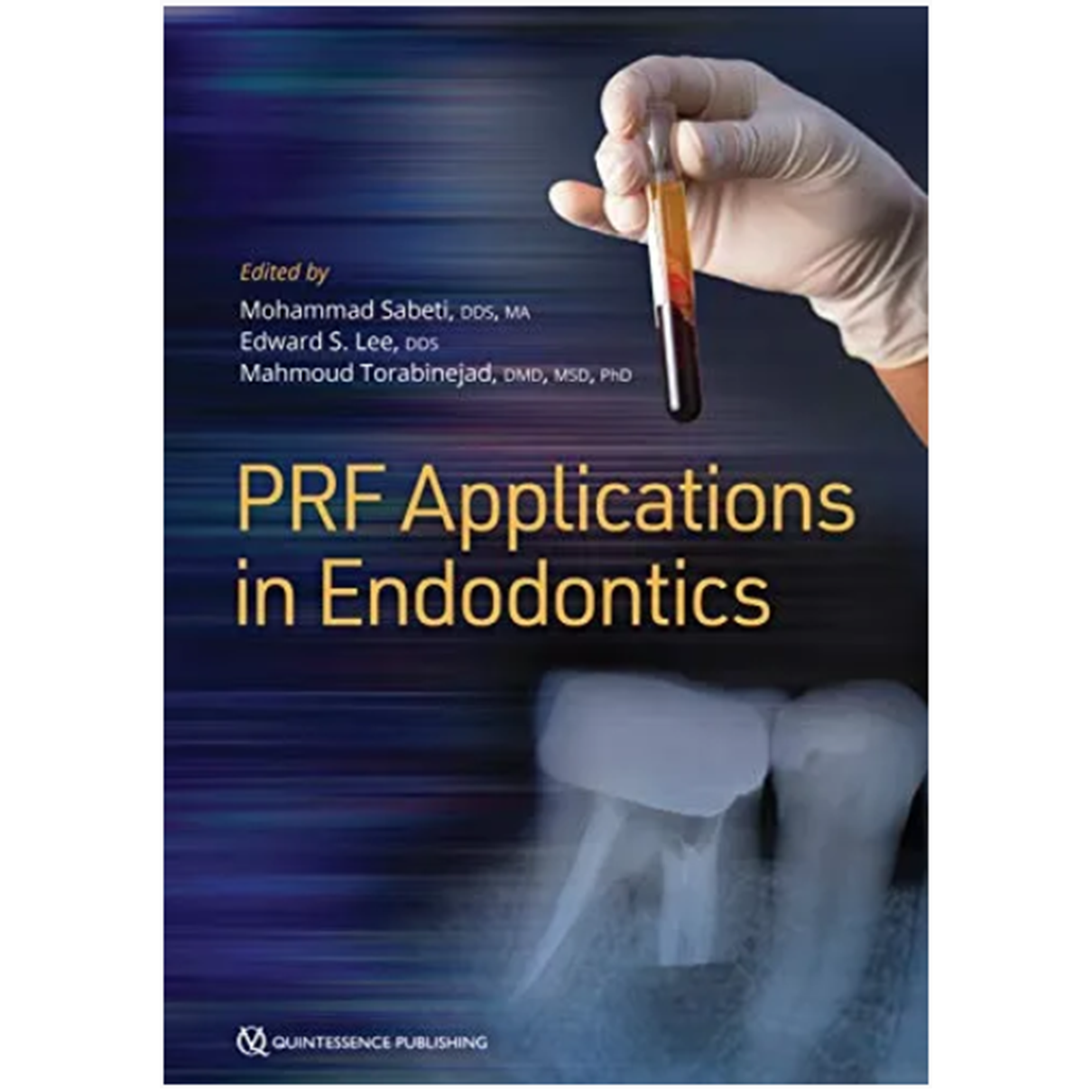 PRF Applications in Endodontics