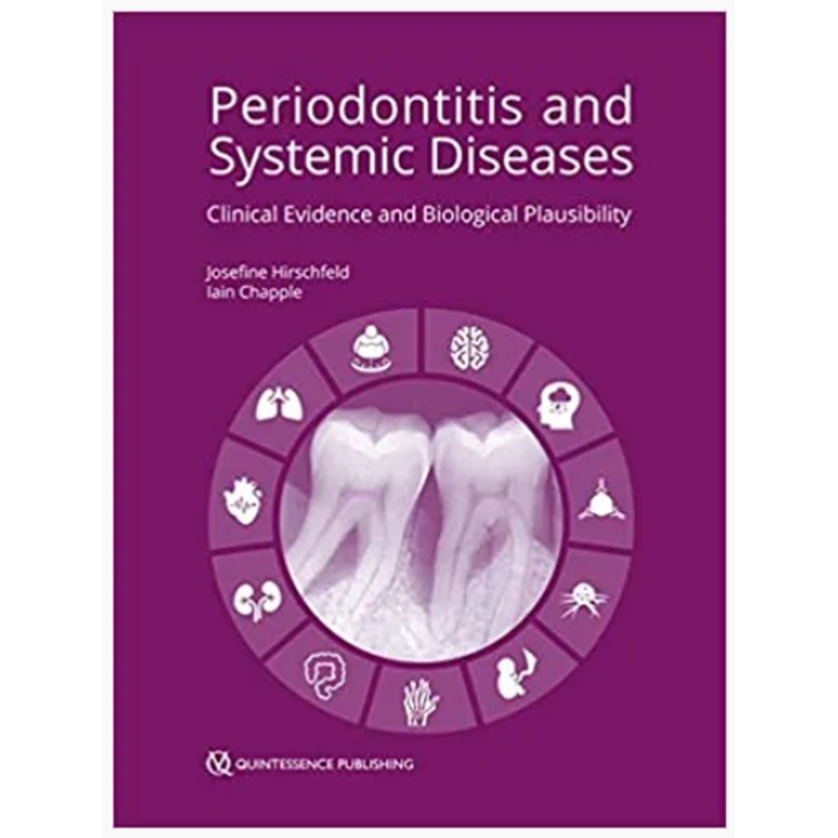 Periodontitis and Systemic Diseases: Clinical Evidence and Biological Plausibility