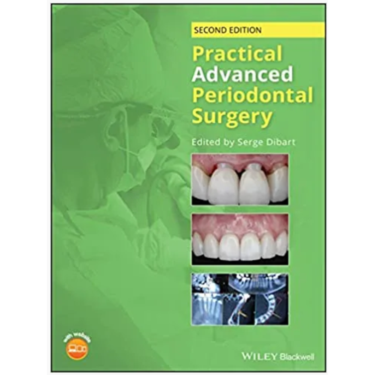 Practical Advanced Periodontal Surgery