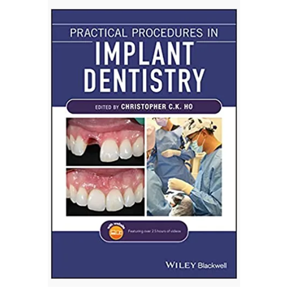 Practical Procedures in Implant Dentistry