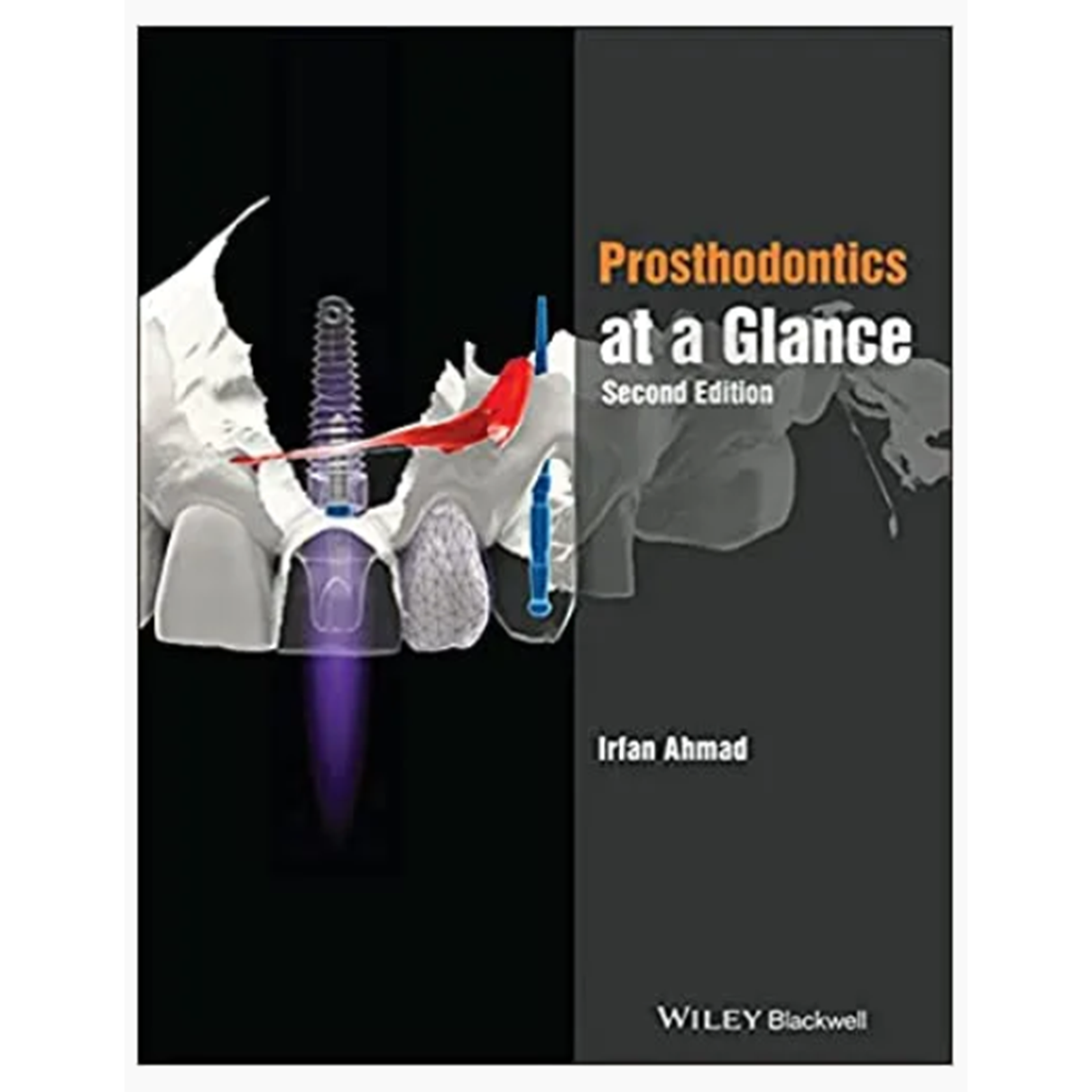 Prosthodontics at a Glance